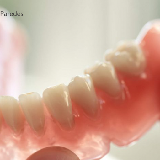 Entenda qual a diferença entre implante e prótese nos dentes