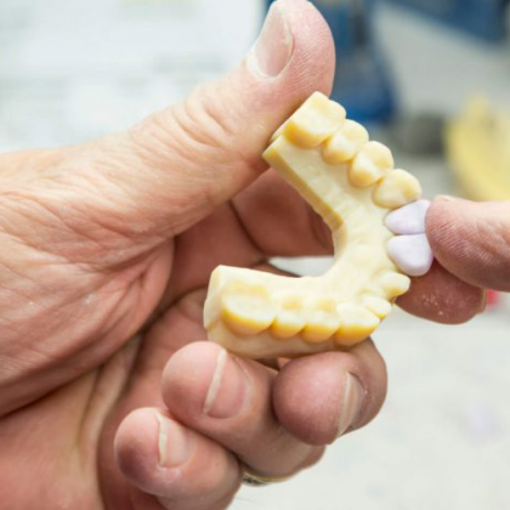 Afinal, como a impressão 3D está sendo usada na odontologia?